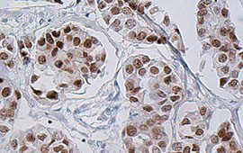 Breast Cancer: ER — Anti-Rabbit HRP (4)